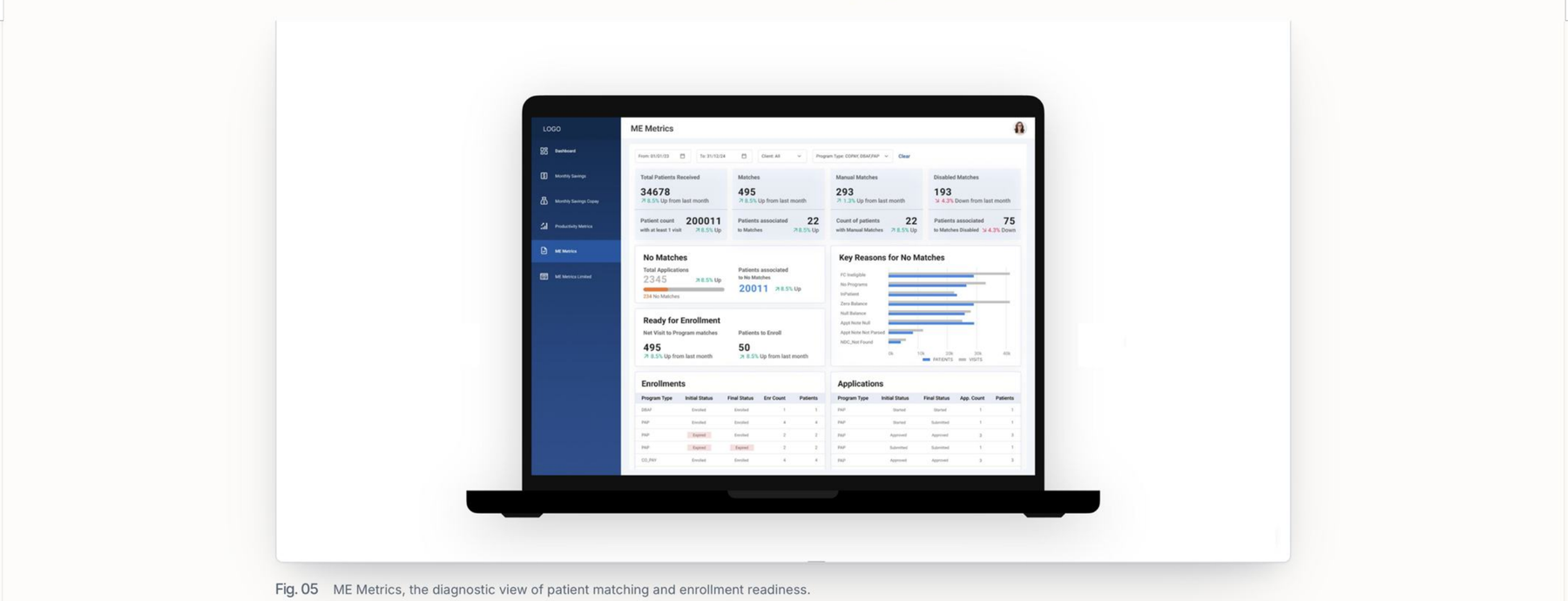 ME Metrics module, the diagnostic view of patient matching and enrollment readiness